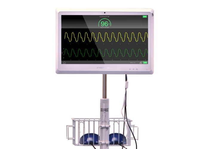 Pulmonary Sensor Manufacturer Picks Cybernet For New Device