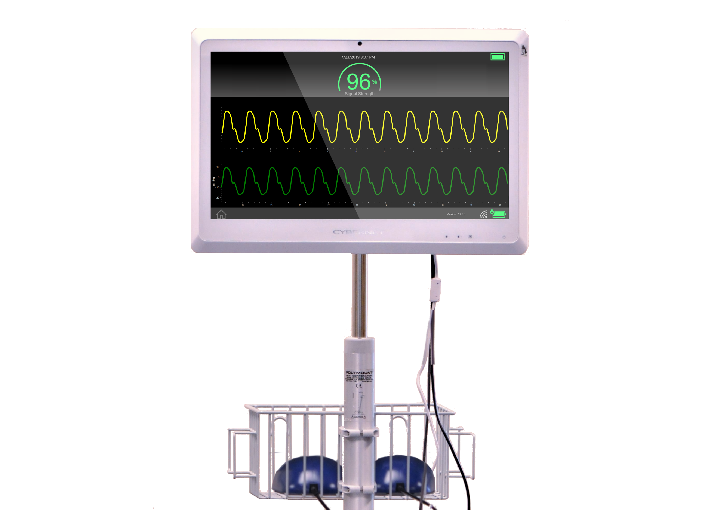 Pulmonary Sensor Manufacturer Picks Cybernet For New Device
